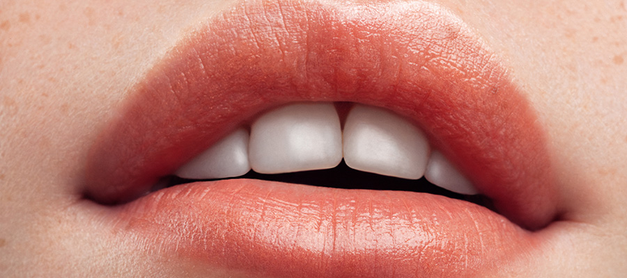 Closeup of woman's lips - not an example of lip flip - your results will vary